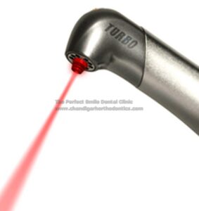 laser-1